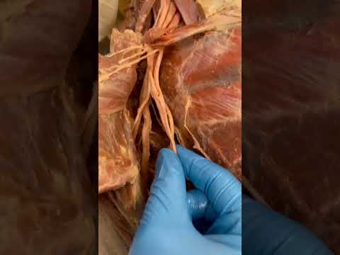 Look At These Amazing Nerves in Your Arm