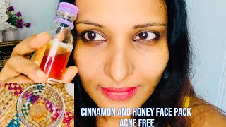 DIY cinnamon and honey ? face pack get pimples and acne free කුරුලැ නැති සමක්ලබා ගන්නගෙදරදිමviral