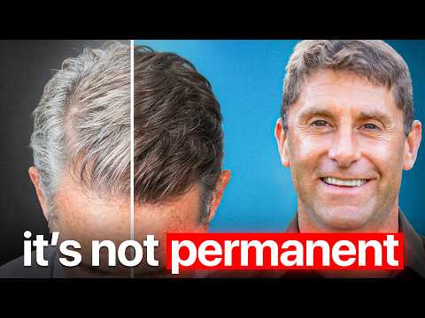 NEW Discovery Could Change Gray Hair Forever