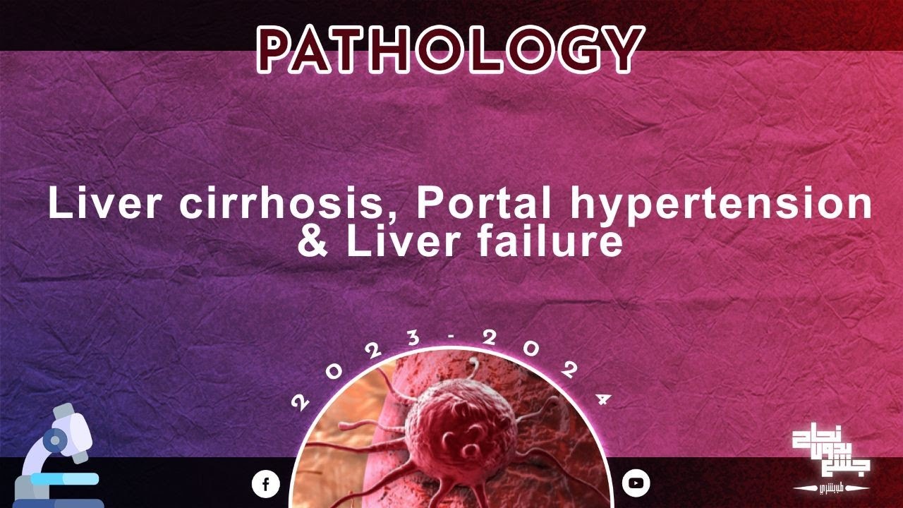 L2 Liver Cirrhosis Portal Hypertension And Liver Failure Pathology l2-liver-cirrhosis-portal-hypertension-and-liver-failure-pathology
