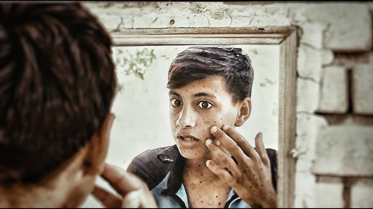 المرض الاحمر _ فلمكم