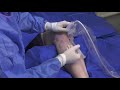 Tenjet patella tendinosis minimally invasive tenotomy procedure