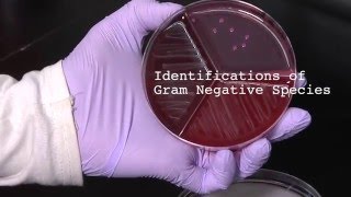 How to Identify Gram Negative Species