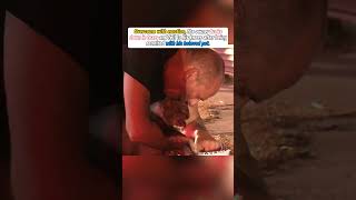 💯🇺🇸Man shares an emotional reunion with his pregnant dog after rescuing her from a burning home.