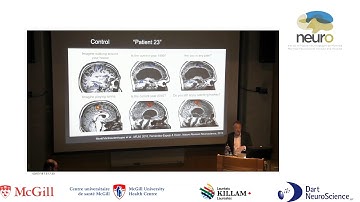 Dr. Owen - Using fMRI to decode mental states in behaviourally non-responsive patients
