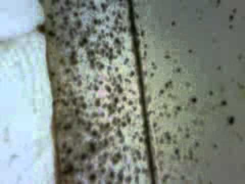 Toxic black mold, apt. #1 (mold in master bedroom and closet) youtube Black mold in bedroom
