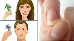 Are Suffering from Insomnia, Thin Brittle Nails and Hair Loss:Take This Food