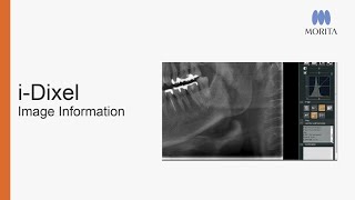 i-Dixel - How to find image information and exposure parameters