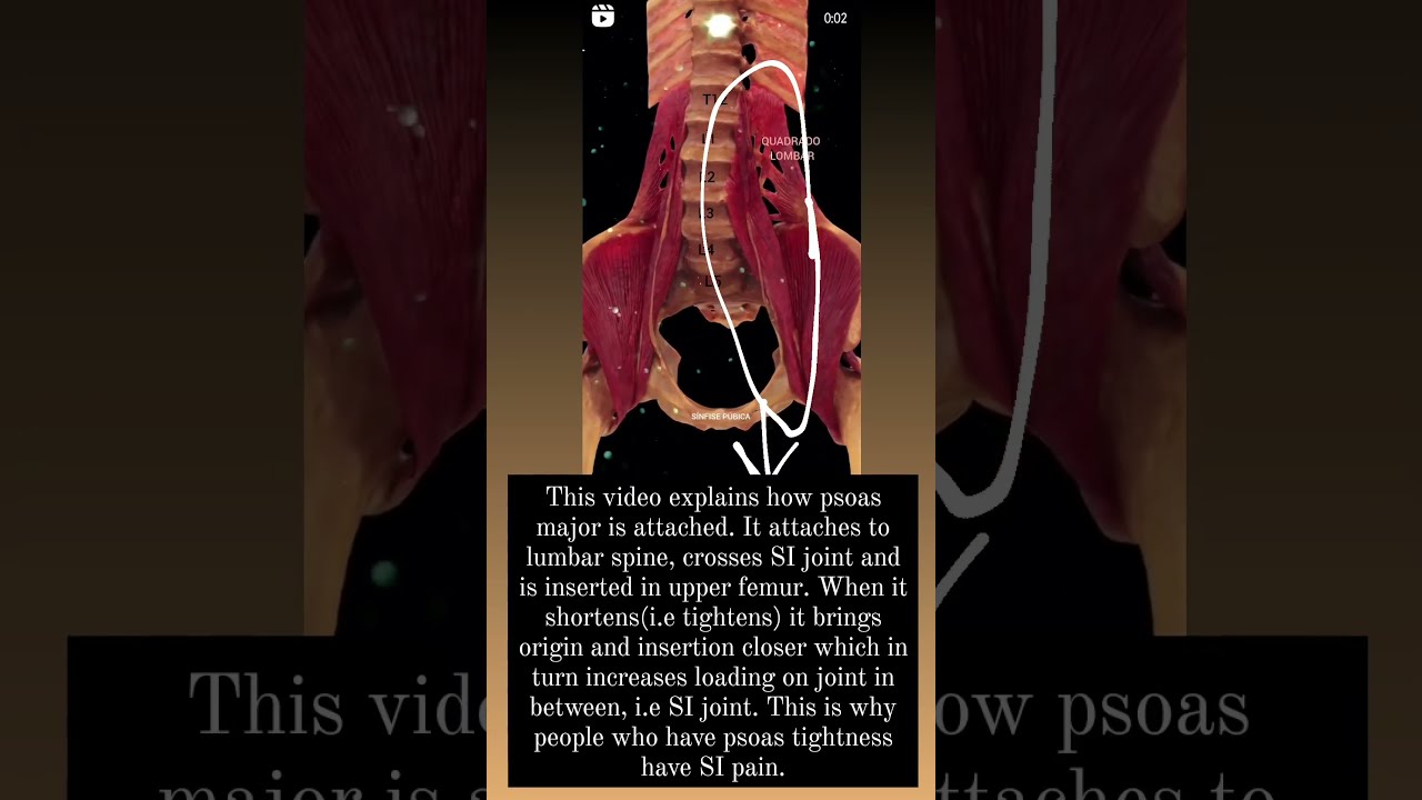 Why iliopsoas tightness causes back pain?  #physio #physiostudent #physioeducator