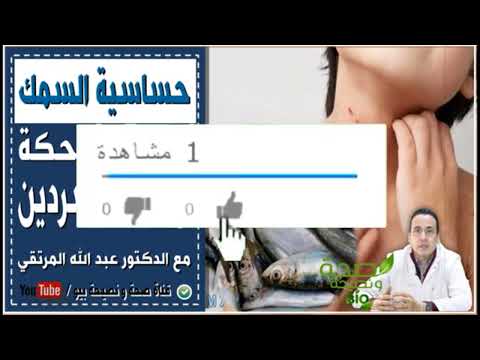 حساسية السمك أو الحكة بسبب السردين متى نصاب بها الدكتور عبد الله المورتقي 