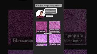 First year pathology resident vs soft tissue tumors screenshot 3