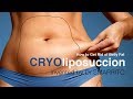 Cryoliposuccion la nouvelle liposuccion pour enlever la graisse abdominale