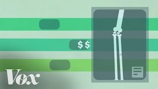 How single-payer health care works, in 2 minutes