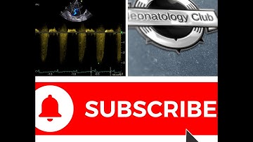 How to estimate RVSp using TR jet?