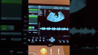 心拍確認 Youtube