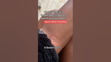 How to Patch Test Like a Dermatologist 👀 Easy at Home Skincare Patch Test! #skincare #derm