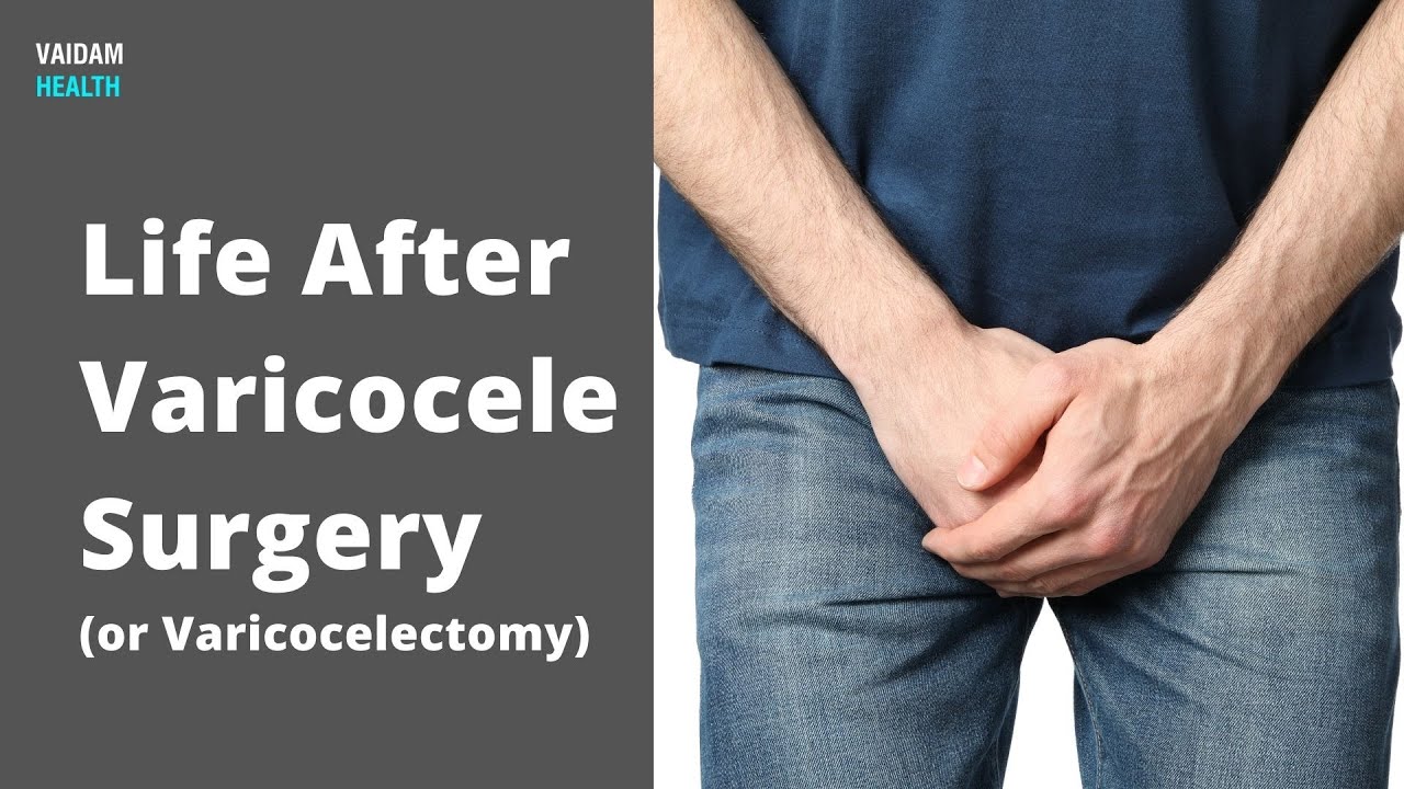 Life after Varicocele Surgery 