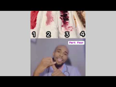 Aina Ya Damu Ya Hedhi Part Four