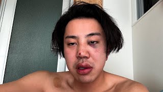 I Was Punched 15 Times and Beaten Up; I Need Your Help.