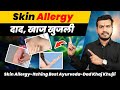 Skin allergyitching best ayurvedadad khaj khujli  drarun mishra mishraveda ep497