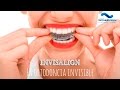 Invisalign: la ortodoncia sin brackets