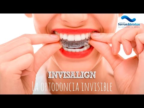 Vídeo: Tratamiento Dental Indoloro: 7 Tratamientos Modernos