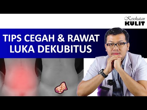 Video: Dalam kedudukan dekubitus sisi kanan?