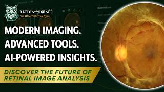 Solving Retinal Imaging Analysis Challenges with AI | RetinaWiseAI Introduction