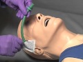 EMS Skills - Nasopharyngeal Airway Insertion