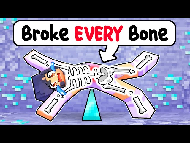 Aphmau Broke EVERY BONE in Minecraft! class=