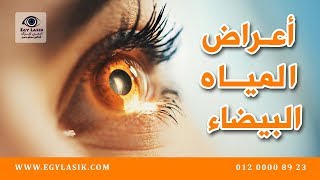 تشوش الرؤية أهم أعراض المياه البيضاء