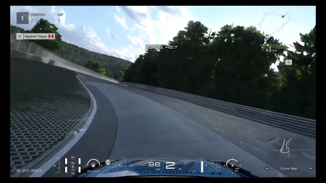 Logitech G923 - Elantra - Nurburgring Laptime Challenge - Hood View