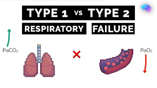 Type 1 vs Type 2 Respiratory Failure | ABG Interpretation | UKMLA | CPSA