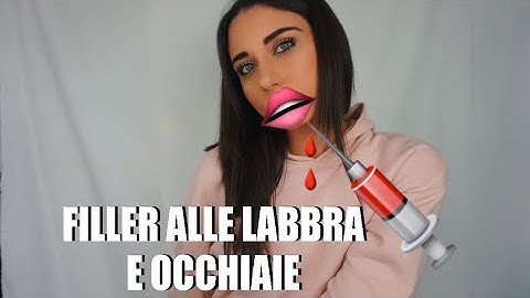 HO FATTO IL FILLER ALLE LABBRA E ALLE OCCHIAIE || Marika Ferrarelli