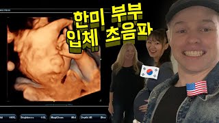 우리의 한국&미국 혼혈 아기 외모는 어떻게 생겼을까?
