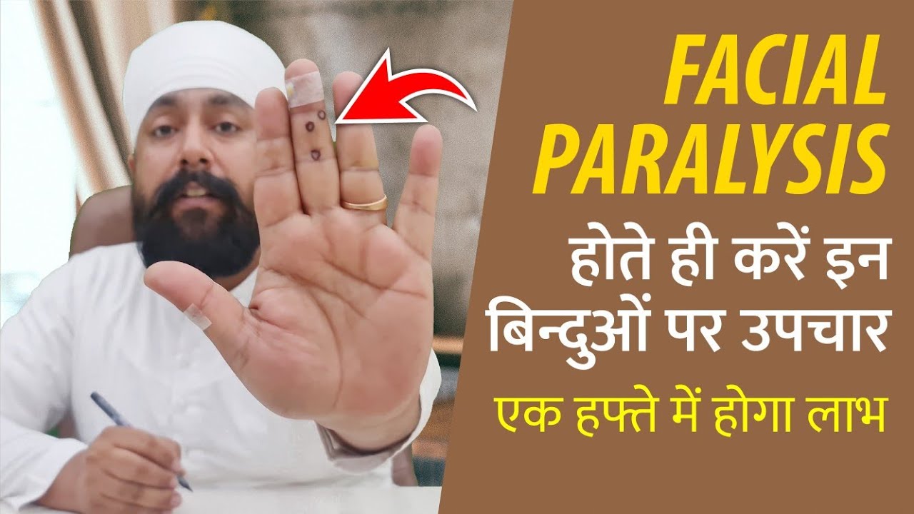 Acupressure Points For Facial Paralysis Bells Palsy Treatment YouTube