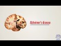What is Alzheimer's disease? Causes, Signs and Symptoms, Diagnosis and Treatment.