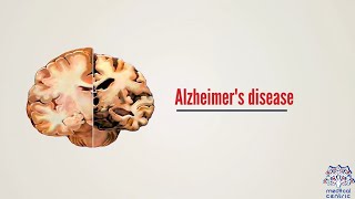 What is Alzheimer