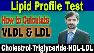 Lipid Profile Test (Cholestrol-Triglyceride-HDL-LDL)