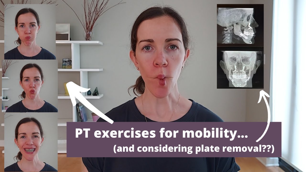 MY HEALING JOURNEY: Physical therapy exercises and contemplating plate ...