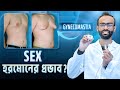           gynecomastia and testosterone sabbir ahmed