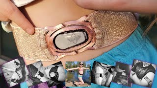 🎁 Protective CGM Bands for Dexcom Libre Omnipod & Medtronic!