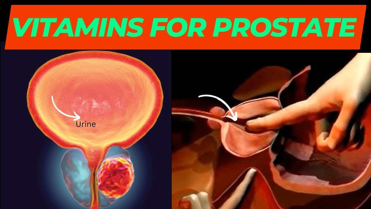 5 Essential vitamins and Minerals for prostate health YouTube