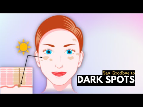 Video: 3 būdai, kaip atsikratyti tamsių dėmių ant veido