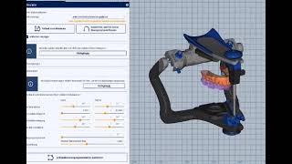 Zebris - Jaw Motion Analyzer