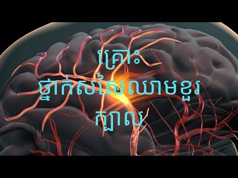 គ្រោះថ្នាក់សសៃឈាមខួរក្បាល