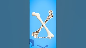 How Strong Are Human Bones? 🤔 Surgeon Reacts