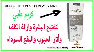 علاج فعال للكلف والتصبغات واثار الحبوب وتفتيح البشرة mela white creme éclaircissant