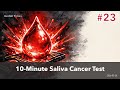 AI Saliva Cancer Test Returns Results in 10 Minutes