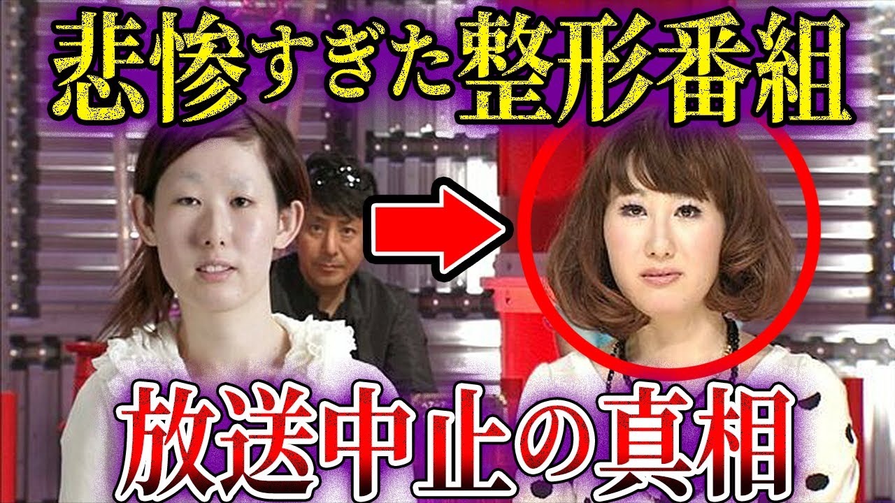 【ゆっくり解説】整形番組ヤラセの闇…ビューティーコロシアムのとんでもない闇と出演者の末路